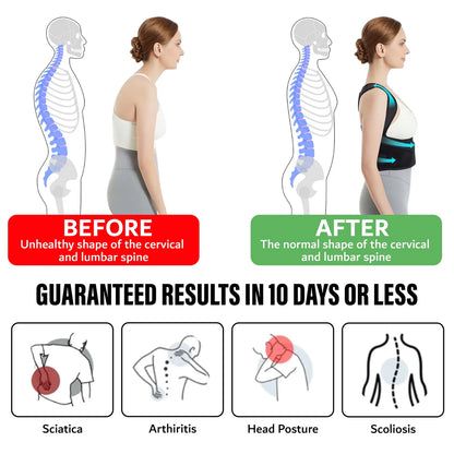 TRUEFIT™ POSTURE CORRECTOR for the TrueU!